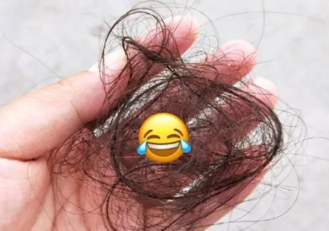 齐齐哈尔治疗掉头发不复发