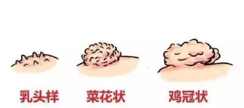 齐齐哈尔治疗疣的医院哪个好？位置在哪