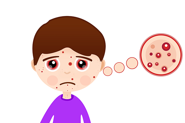 痘痘好了以后皮肤会变好吗？-齐齐哈尔皮肤病医院